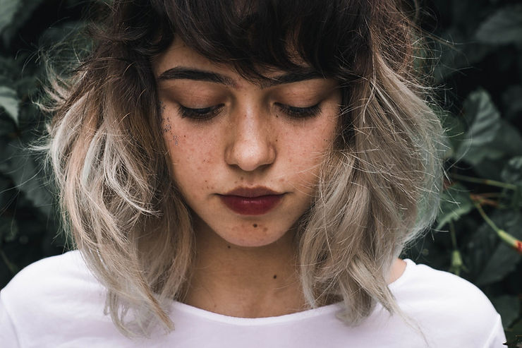 Naturopathic Approaches to Acne
