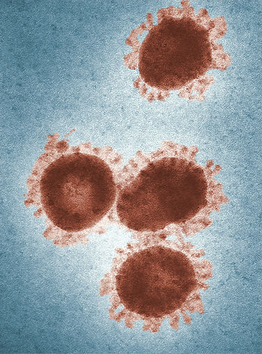 How to Protect Against The Coronavirus (COVID-19)